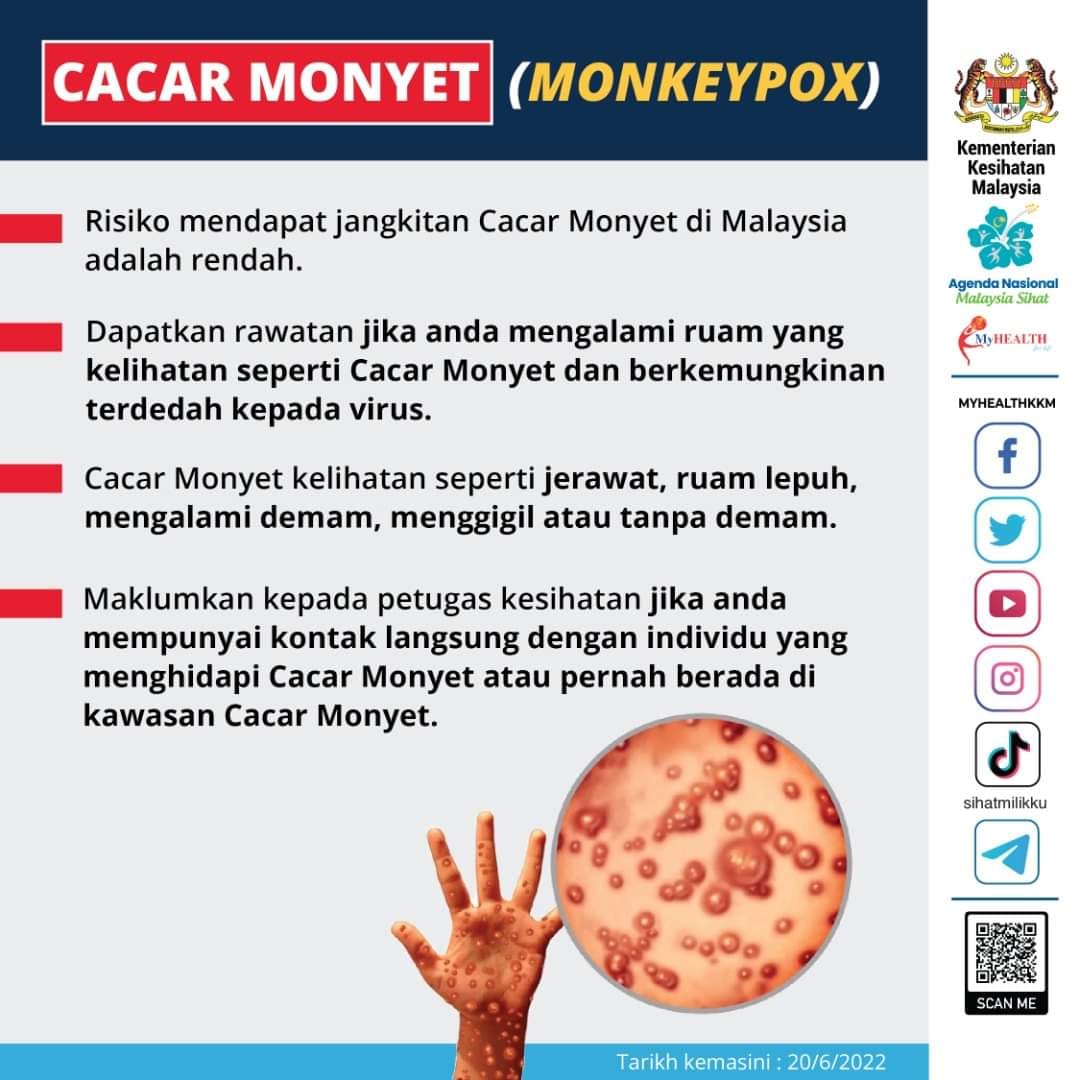 CACAR MONYET MONKEYPOX