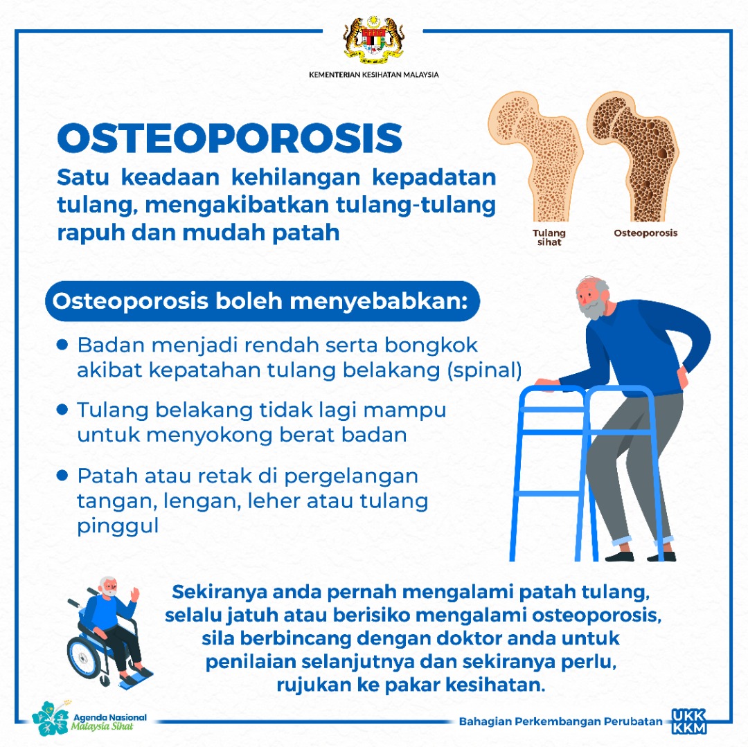 OSTEOPOROSIS